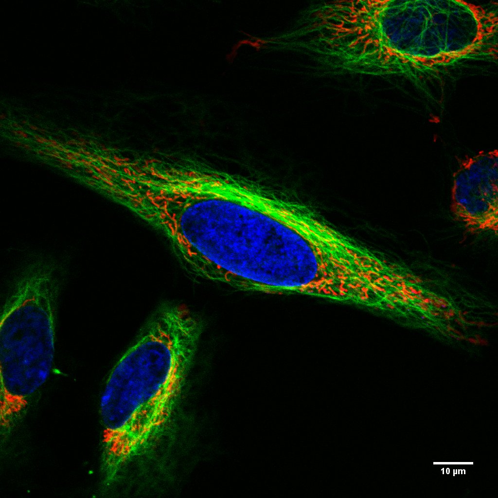 Multicolor fluorescence image of a living cell