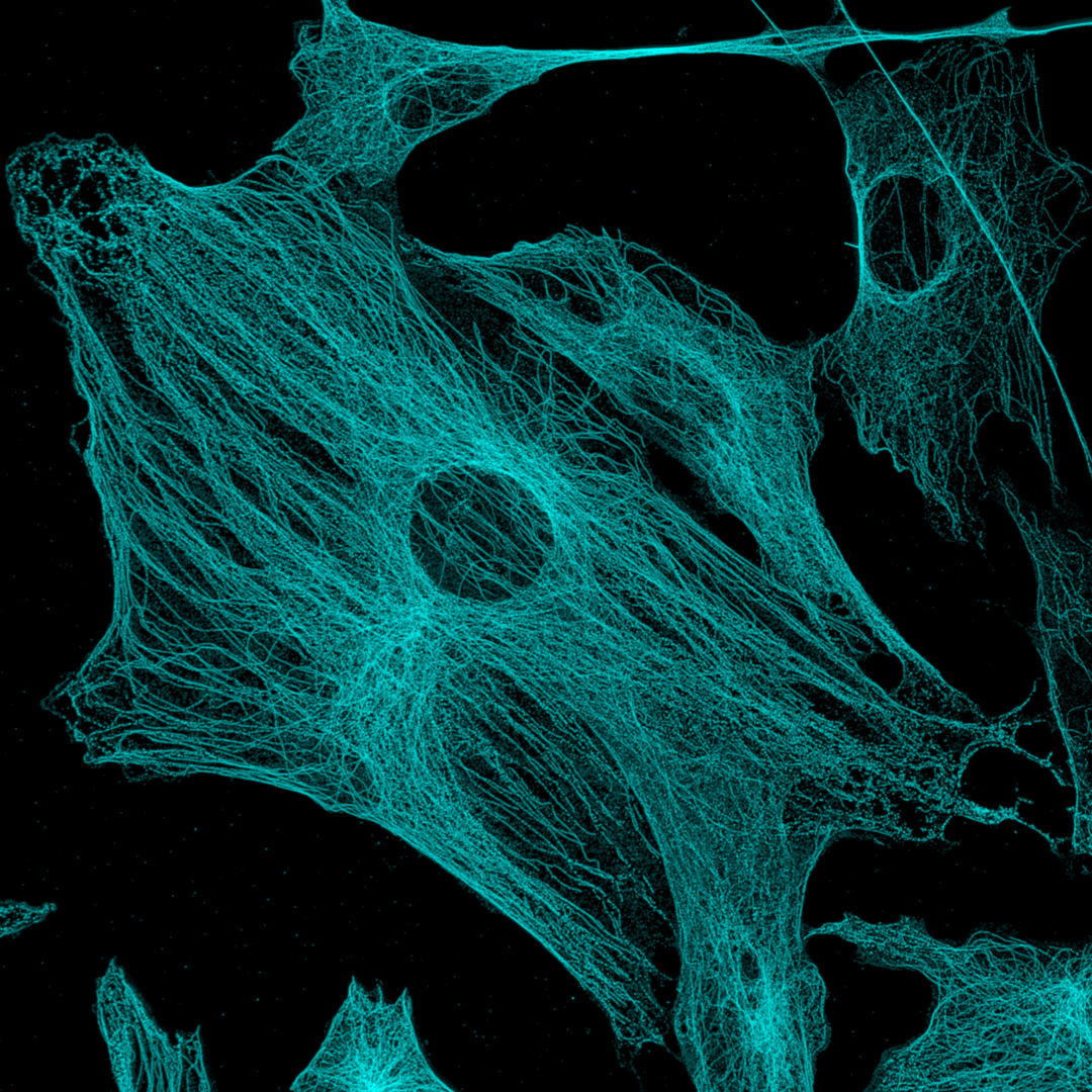 Fluorescence microscopy image of microtubules